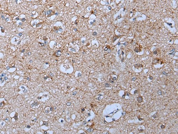 YPEL5 Antibody
