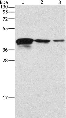 TWF2 / PTK9L Antibody