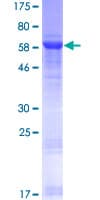 Human NFYC Protein (Recombinant GST)