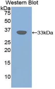 Betaglycan / TGFBR3 Antibody (aa210-465)
