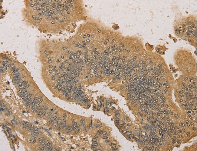 Polyclonal Rabbit anti-Human PRDM14 Antibody (IHC)