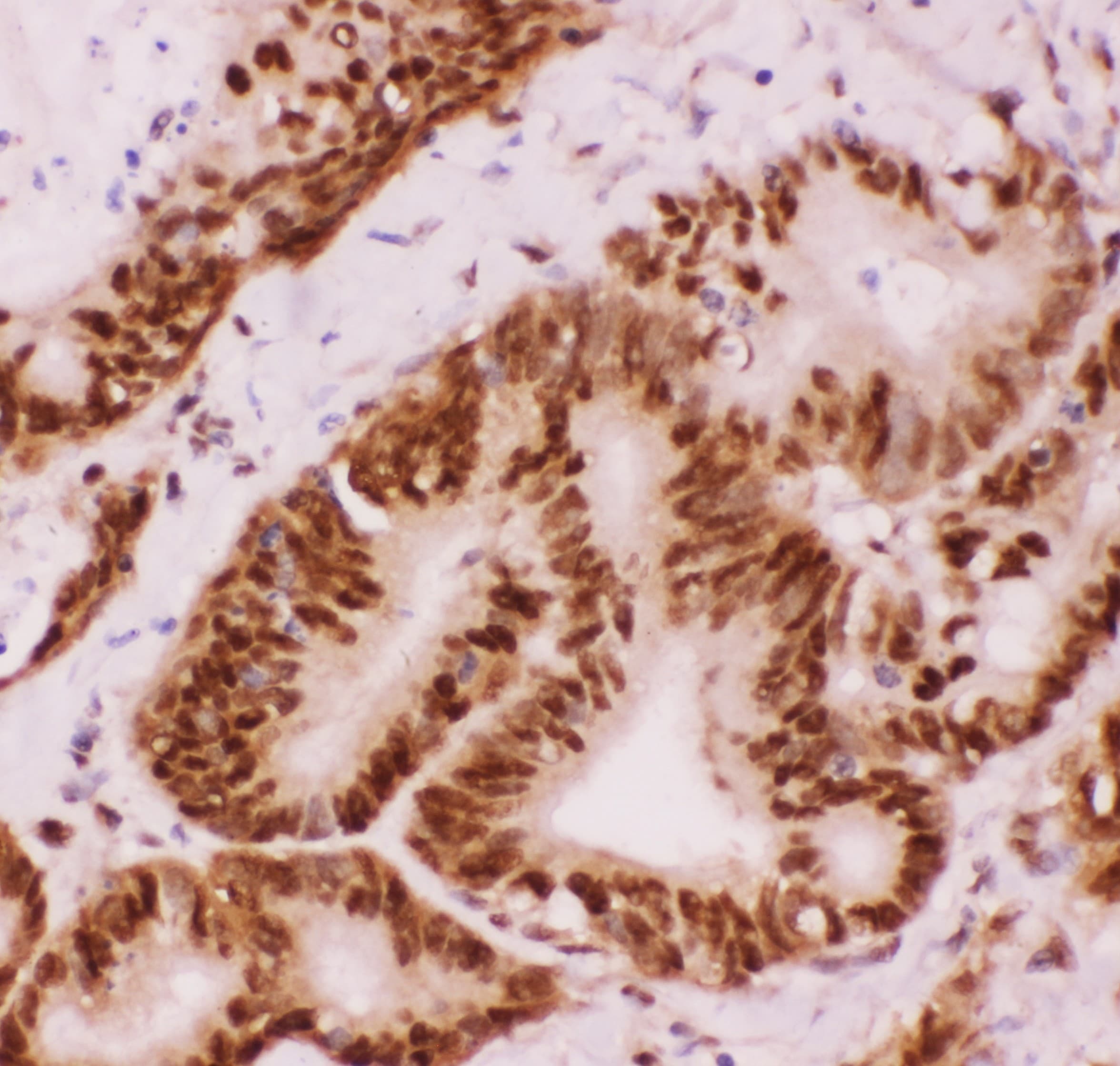 ATF2 Antibody (aa93-450)