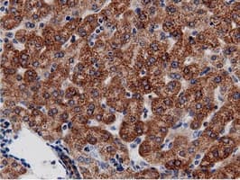 AK5 / Adenylate Kinase 5 Antibody (clone OTI2F9)