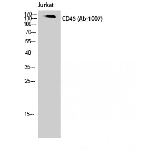 Polyclonal Rabbit anti-Human CD45 / LCA Antibody (950-1030 aa, WB)