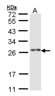 IHC-plus™ Polyclonal Rabbit anti-Human RNF114 / ZNF313 Antibody (aa1-228, IHC, WB)