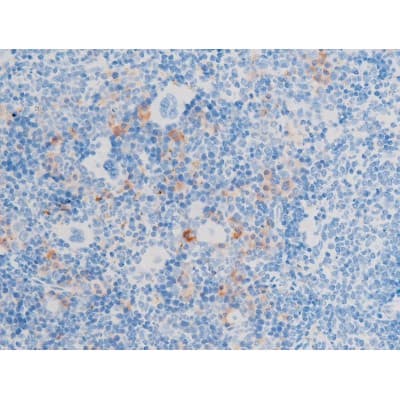 LIMK1 / LIMK Antibody (phospho-Thr508,pThr505)