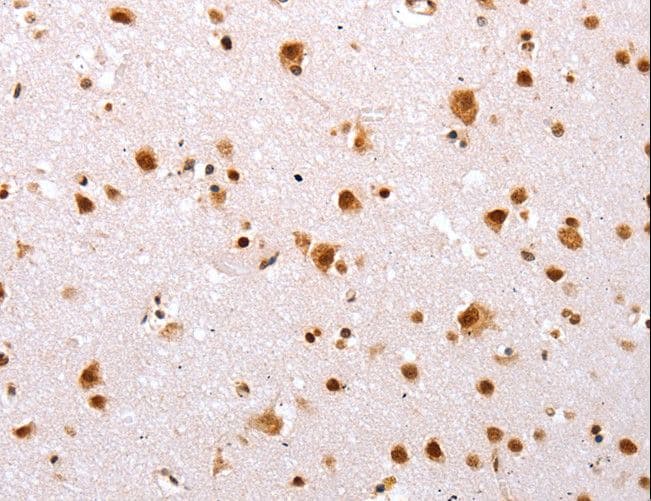 Polyclonal Rabbit anti-Human TBX2 Antibody (IHC)