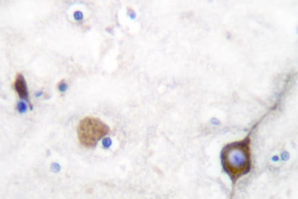 SYP / Synaptophysin Antibody (Leu128)