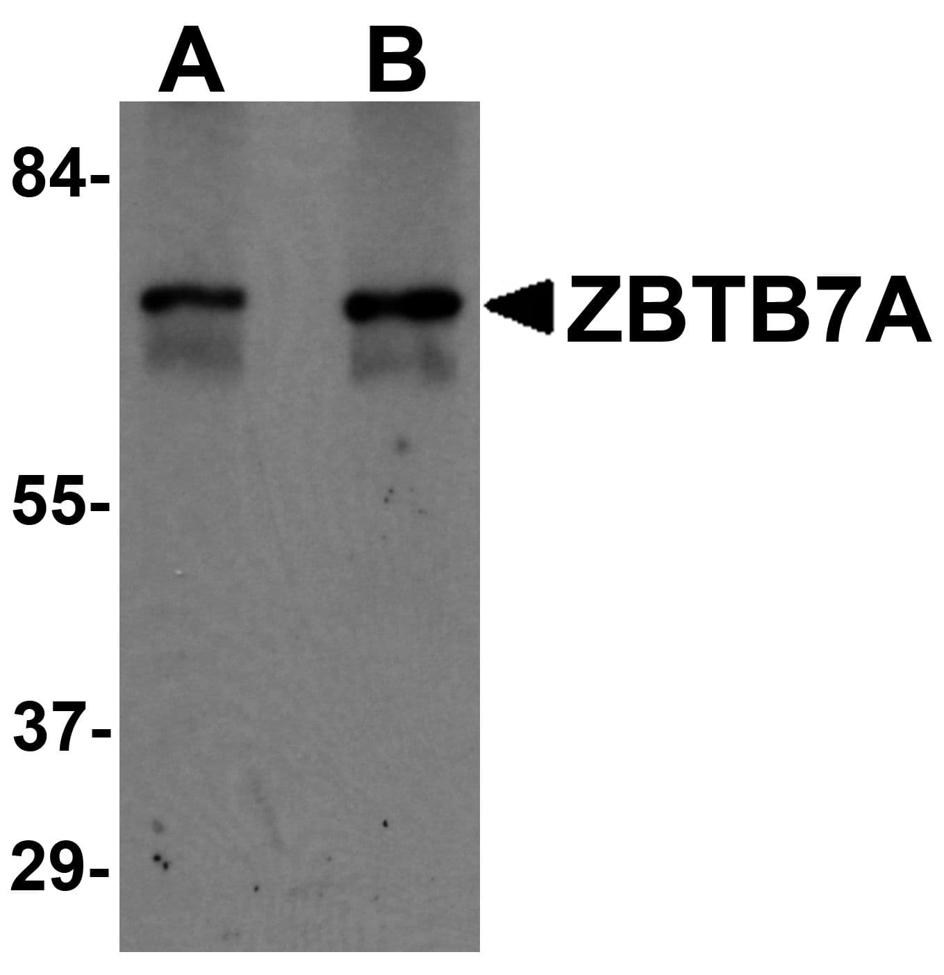 IHC-plus™ Polyclonal Rabbit anti-Human ZBTB7A / Pokemon Antibody (IHC, IF, WB)