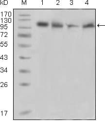Monoclonal Mouse anti-Human PTK2B / PYK2 Antibody (clone 5E2D5, Amino Acid: 815-997, IHC, WB)