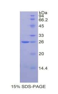Rat TIMP3 Protein (Recombinant His)