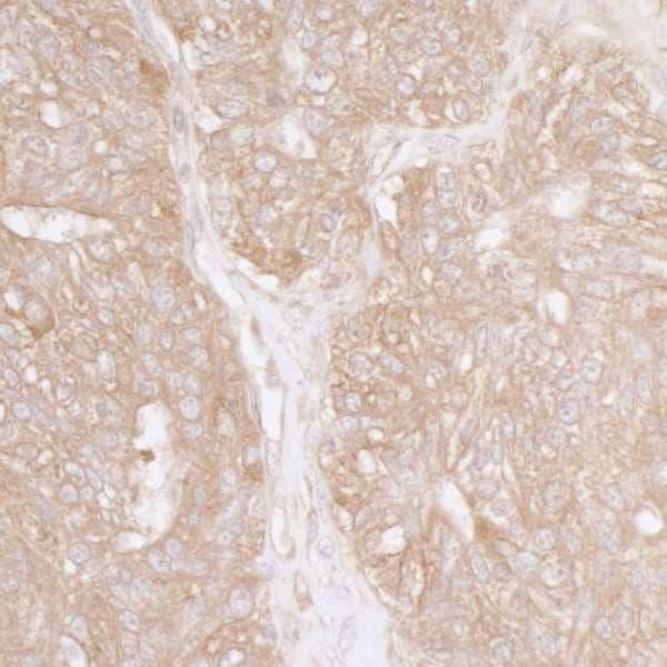 RPS3A / Ribosomal Protein S3A Antibody (aa175-225)
