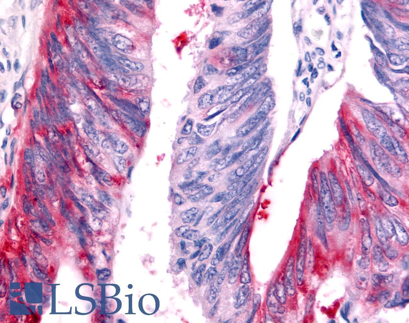 PathPlus™ Polyclonal Rabbit anti-Human HUNK / B19 Antibody (Kinase Domain, IHC)