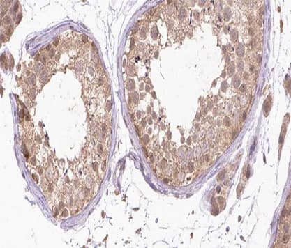 RARA / RAR Alpha Antibody (phospho-Ser77)