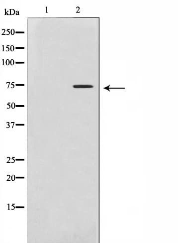 Polyclonal Rabbit anti-Human IL2RB / CD122 Antibody (IHC, IF, WB)