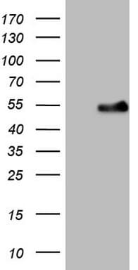 Monoclonal Mouse anti-Human WTAP Antibody (clone OTI12G6, Carrier-free, aa2-106, IHC, WB)