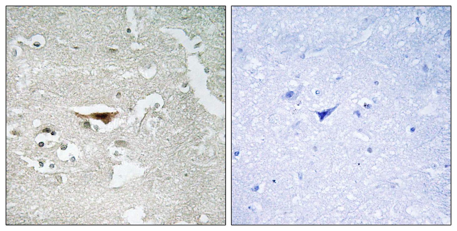 PKIB Antibody