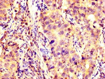 KCNAB1 Antibody