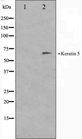 Polyclonal Rabbit anti-Human KRT5 / CK5 / Cytokeratin 5 Antibody (IHC, IF, WB)