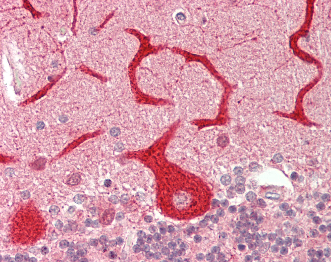 STS / ASC / Steroid Sulfatase Antibody (aa396-445)