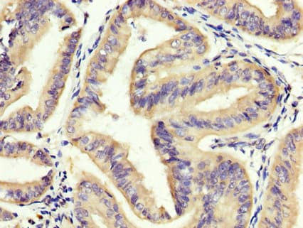 Polyclonal Rabbit anti-Human Eomesodermin / EOMES Antibody (IHC, WB)
