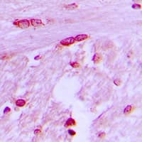 BTF3L4 Antibody (Internal)