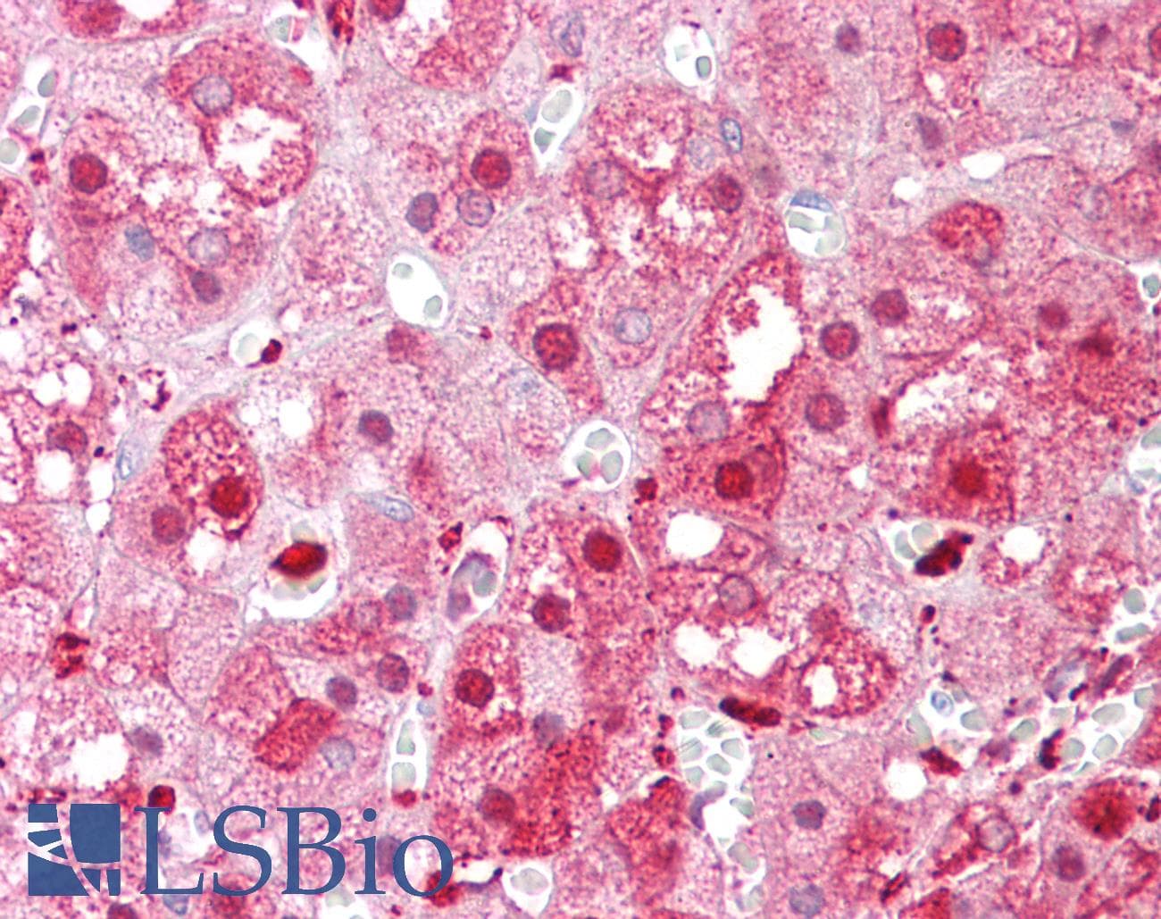 IHC-plus™ PEBP1 / RKIP Antibody (aa1-30)
