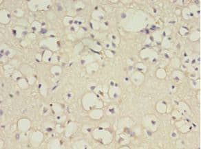 IHC-plus™ B4GAT1 / B3GNT1 Antibody