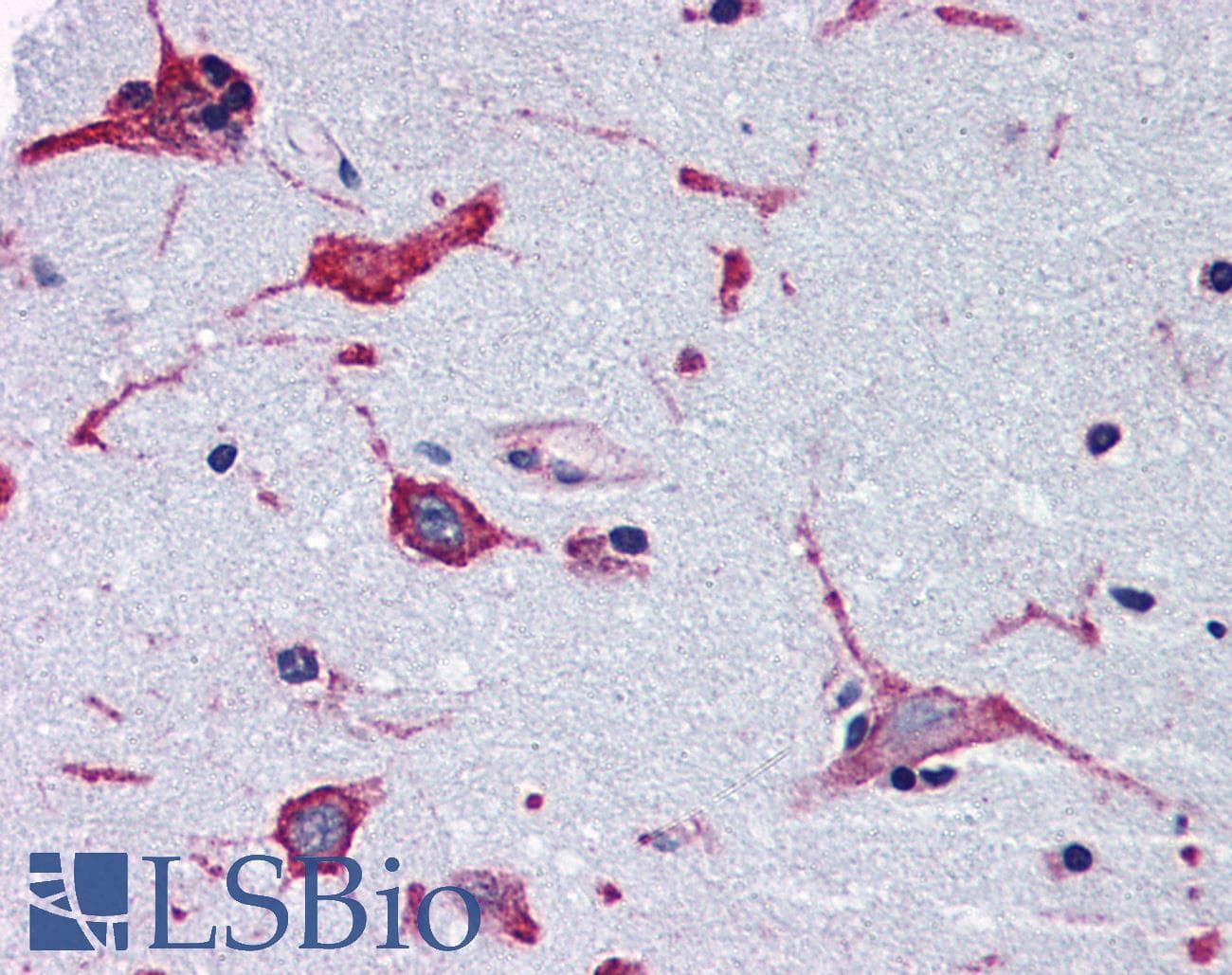 IHC-plus™ ADORA2B/Adenosine A2B Receptor Antibody (Internal)