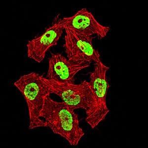 HNRPM / HNRNPM Antibody (clone 5G6C11)
