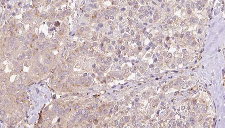 SLC13A2 / NaCT Antibody