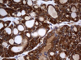 NME1 / NM23 Antibody (clone OTI2H10)