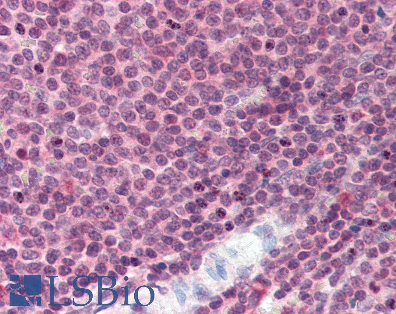 BCL6 Antibody (Internal)