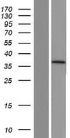 TRIM7 Protein (Over-Expression Lysate Myc-DDK (Flag))