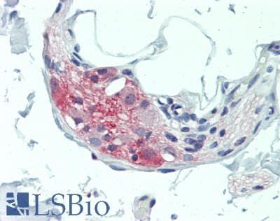 IHC-plus™ TAC1 Antibody