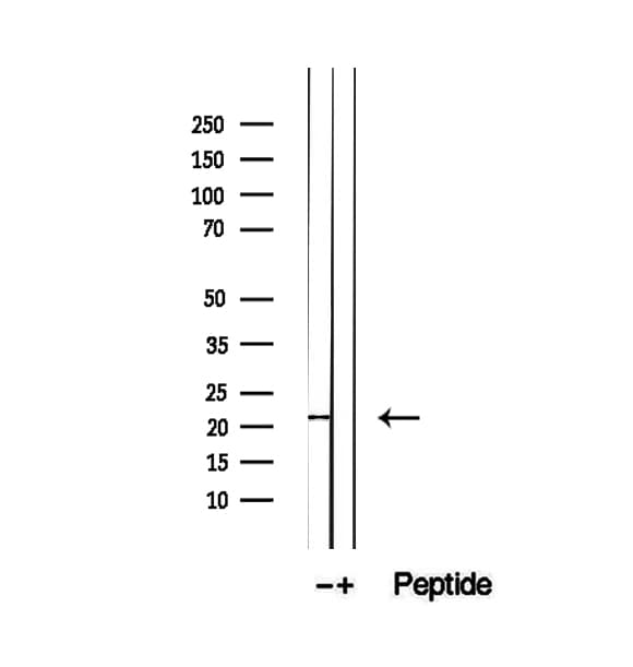 Polyclonal Rabbit anti-Human PTP4A1 / PRL-1 Antibody (IHC, IF, WB)