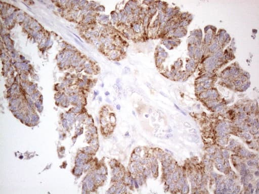 Monoclonal Mouse anti-Human DJ858B16.2 / PISD Antibody (clone OTI4G5, aa80-340, IHC, WB)