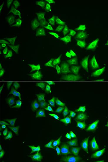 CCBL1 Antibody