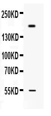 COL1A1 / Collagen I Alpha 1 Antibody
