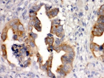 SULT2B1 / Sulfotransferase 2B1 Antibody