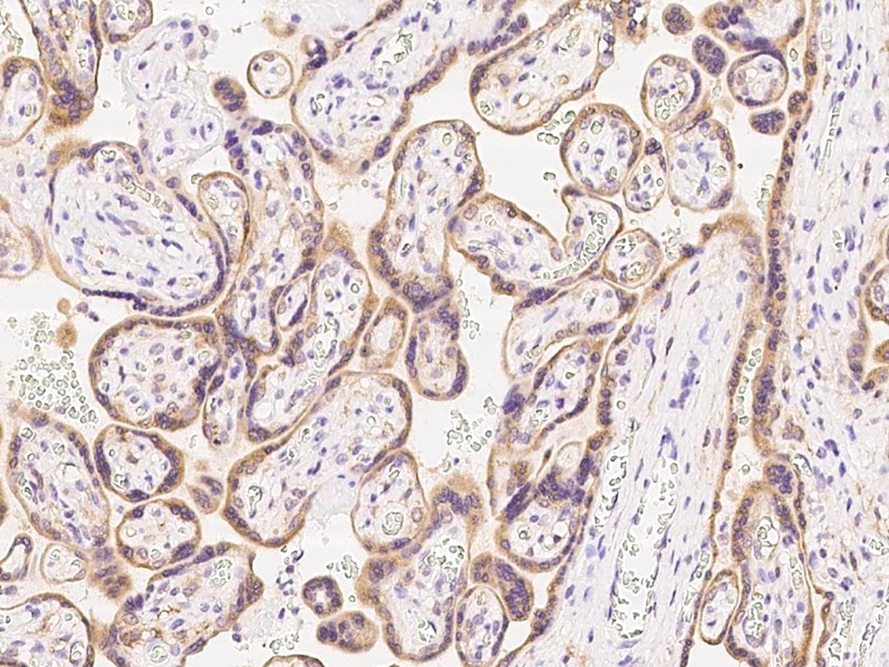 GRAMD3 Antibody