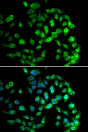 Polyclonal Rabbit anti-Human GPS1 / CSN1 Antibody (IHC, IF, WB)