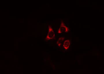 Polyclonal Rabbit anti-Human IRF3 Antibody (IHC, IF, WB)