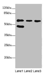 Polyclonal Rabbit anti-Human FLVCR2 Antibody (IHC, WB)