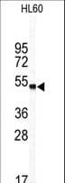 CCN4 / WISP1 Antibody (aa171-200)