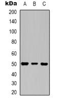 TUBB3 / Tubulin Beta 3 Antibody
