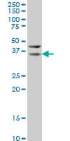 Monoclonal Mouse anti-Human HEYL Antibody (clone 1F6, IHC, IF, WB)