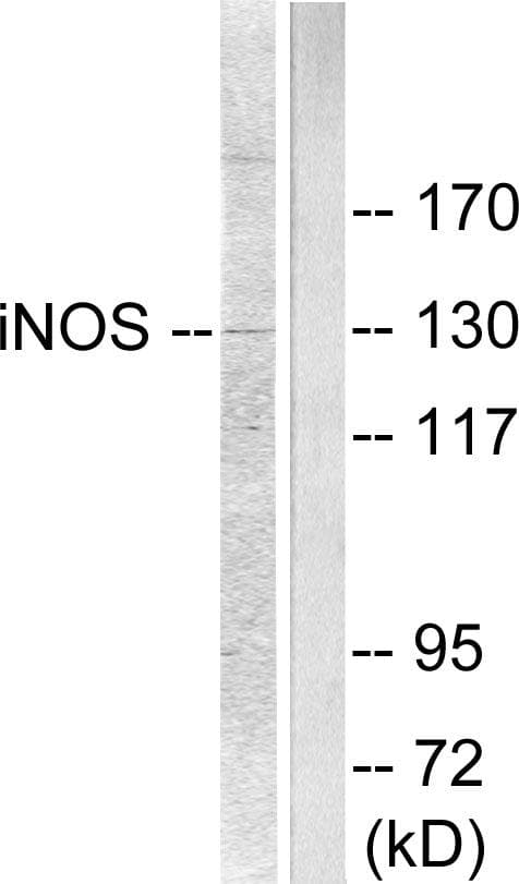 NOS2 / iNOS Antibody