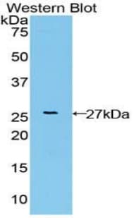 FGFRL1 Antibody (aa168-378, Cy3)