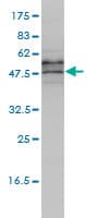 Monoclonal Mouse anti-Human EIF5 Antibody (clone 2E6-4C12, IHC, IF, WB)